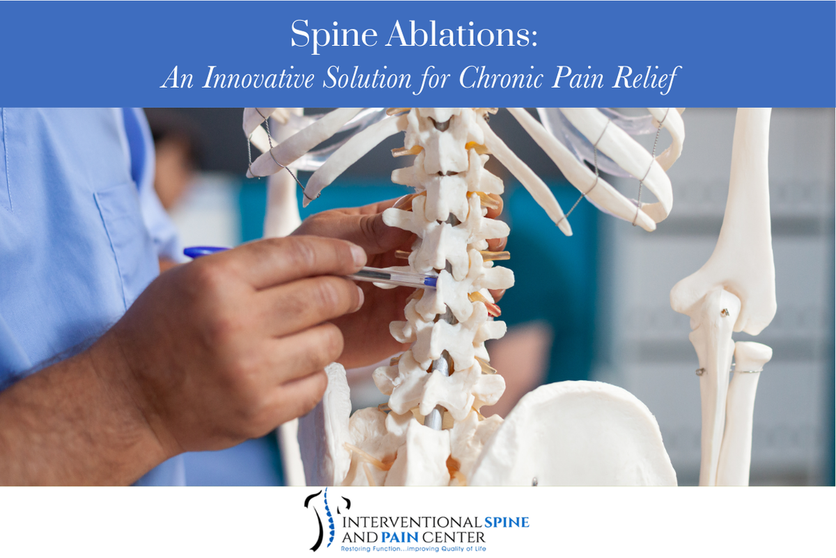 Spine Ablations: An Innovative Solution for Chronic Pain Relief